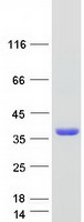 Coomassie blue staining of purified SMUG1 protein