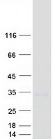 Coomassie blue staining of purified TM4SF20 protein