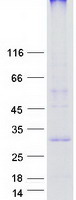 protq53ry4 krtcap3 human recombinant protein