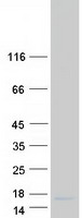 protq56p42 pydc2 human recombinant protein