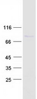 protq58a45 pan3 human recombinant protein