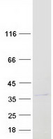 Coomassie blue staining of purified LRRC10 protein