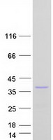 protq5gj75 tnfaip8l3 human recombinant protein