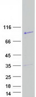 Coomassie blue staining of purified RTL5 protein