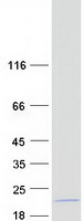Coomassie blue staining of purified TTC32 protein