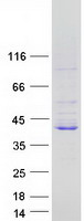 Coomassie blue staining of purified LRRC73 protein