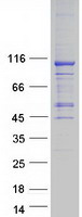 protq5jtz9 alanyl trna synthetase 2 aars2 human recombinant protein