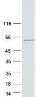 protq5jvs0 habp4 human recombinant protein