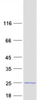 Coomassie blue staining of purified TMEM31 protein