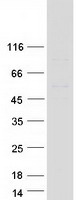 Coomassie blue staining of purified EOGT protein