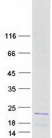 protq5qnw6 hist2h2bf human recombinant protein