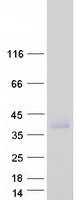 Coomassie blue staining of purified CALHM6 protein