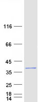 Coomassie blue staining of purified PPM1L protein