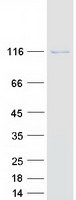 protq5st30 vars2 human recombinant protein
