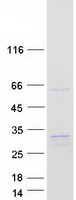 protq5t013 hyi human recombinant protein