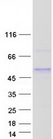Coomassie blue staining of purified ZNF362 protein