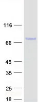 protq5t1v6 ddx59 human recombinant protein