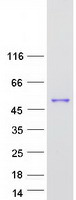 Coomassie blue staining of purified SPOUT1 protein