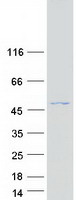 Coomassie blue staining of purified OTUD3 protein
