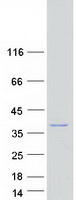 Coomassie blue staining of purified IBA57 protein