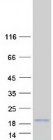 Coomassie blue staining of purified LCE3E protein