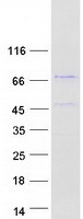 protq5t619 znf648 human recombinant protein