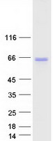 protq5t8d3 acbd5 human recombinant protein