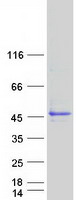 Coomassie blue staining of purified NDUFAF5 protein