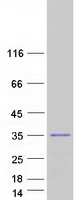Coomassie blue staining of purified ZC2HC1B protein