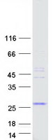 protq5tgi4 samd5 human recombinant protein