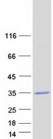 Coomassie blue staining of purified ABHD17B protein