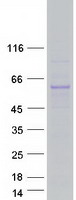 protq5vtq0 ttc39b human recombinant protein