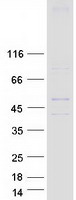 Coomassie blue staining of purified HHAT protein