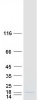 protq5vu69 c1orf189 human recombinant protein