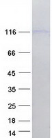 protq5vug0 sfmbt2 human recombinant protein