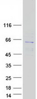 protq5vv42 cdkal1 human recombinant protein