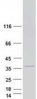 protq5vvh5 irak1bp1 human recombinant protein