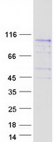protq5vwt5 fyb2 human recombinant protein