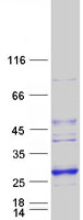 Coomassie blue staining of purified LYPLAL1 protein