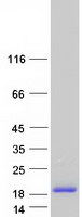 Coomassie blue staining of purified SAMD13 protein
