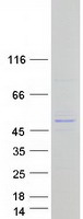 protq5vyv7 slx4ip human recombinant protein
