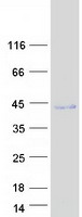 Coomassie blue staining of purified TMEM268 protein