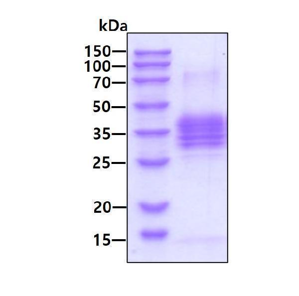 3ug by SDS-PAGE under reducing condition and visualized by coomassie blue stain