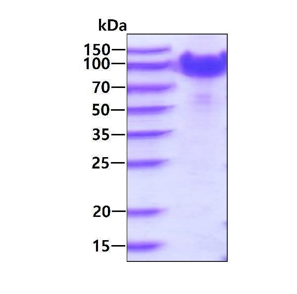 3ug by SDS-PAGE under reducing condition and visualized by coomassie blue stain