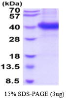 3ug by SDS-PAGE under reducing condition and visualized by coomassie blue stain