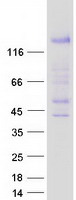 Coomassie blue staining of purified TSHZ3 protein