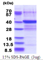 3ug by SDS-PAGE under reducing condition and visualized by coomassie blue stain