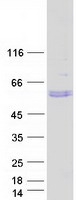 protq658p3 steap3 human recombinant protein