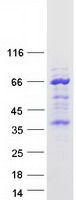 protq68d42 tmem215 human recombinant protein
