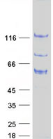 Coomassie blue staining of purified ARHGAP17 protein